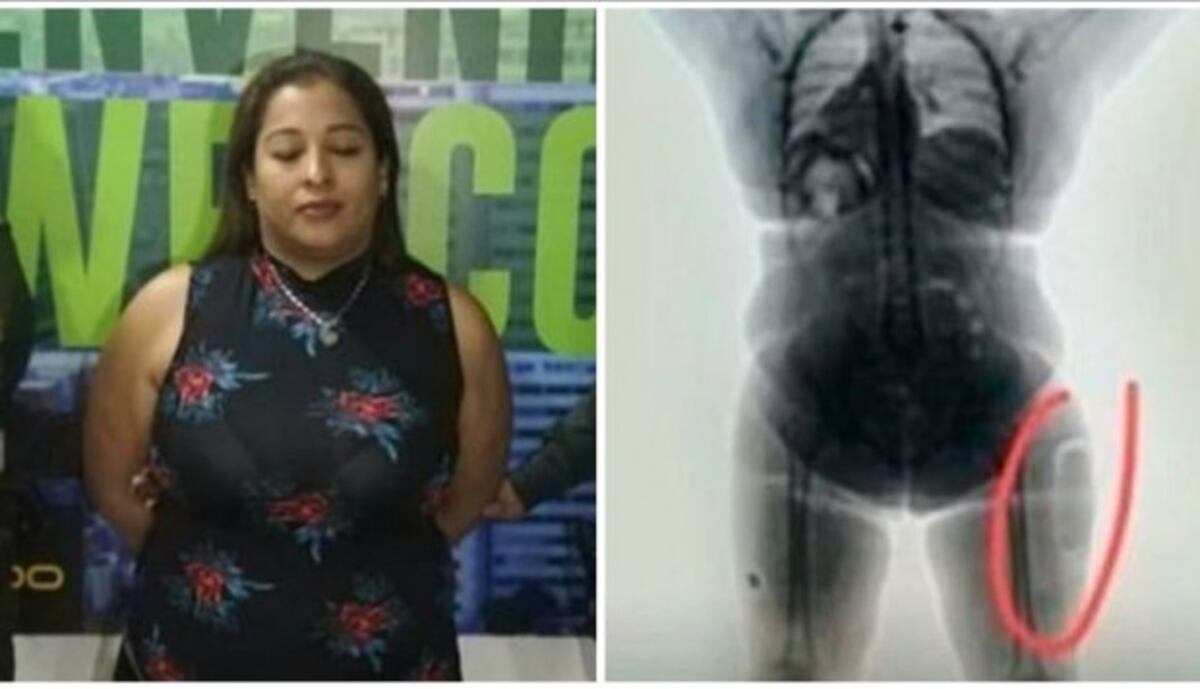Mujer quiso traficar casi un kilo de cocaína líquida dentro de sus muslos