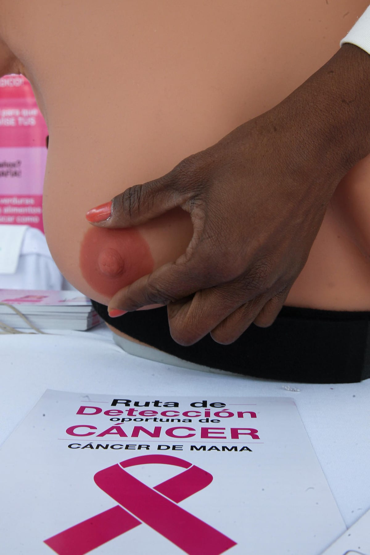 Expertos alertan sobre la falta de registros de cáncer de mamá en América Latina 