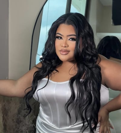 Shelsy rompe el silencio y revela la dura batalla que vive por su salud