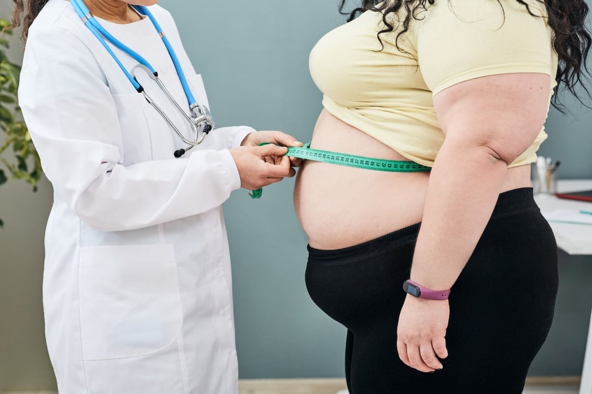 ¿Quieres bajar de peso? Doctora explica cómo lograr cambios sostenibles al tratar la obesidad