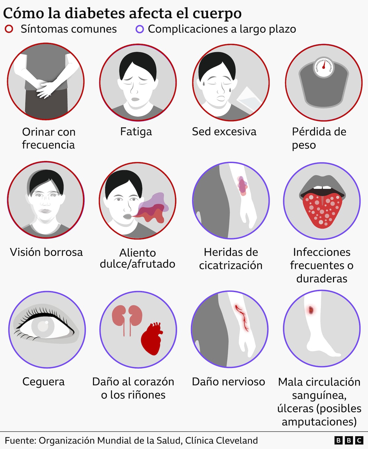 Diabetes tipo 5, la nueva y desconocida categoría de la enfermedad