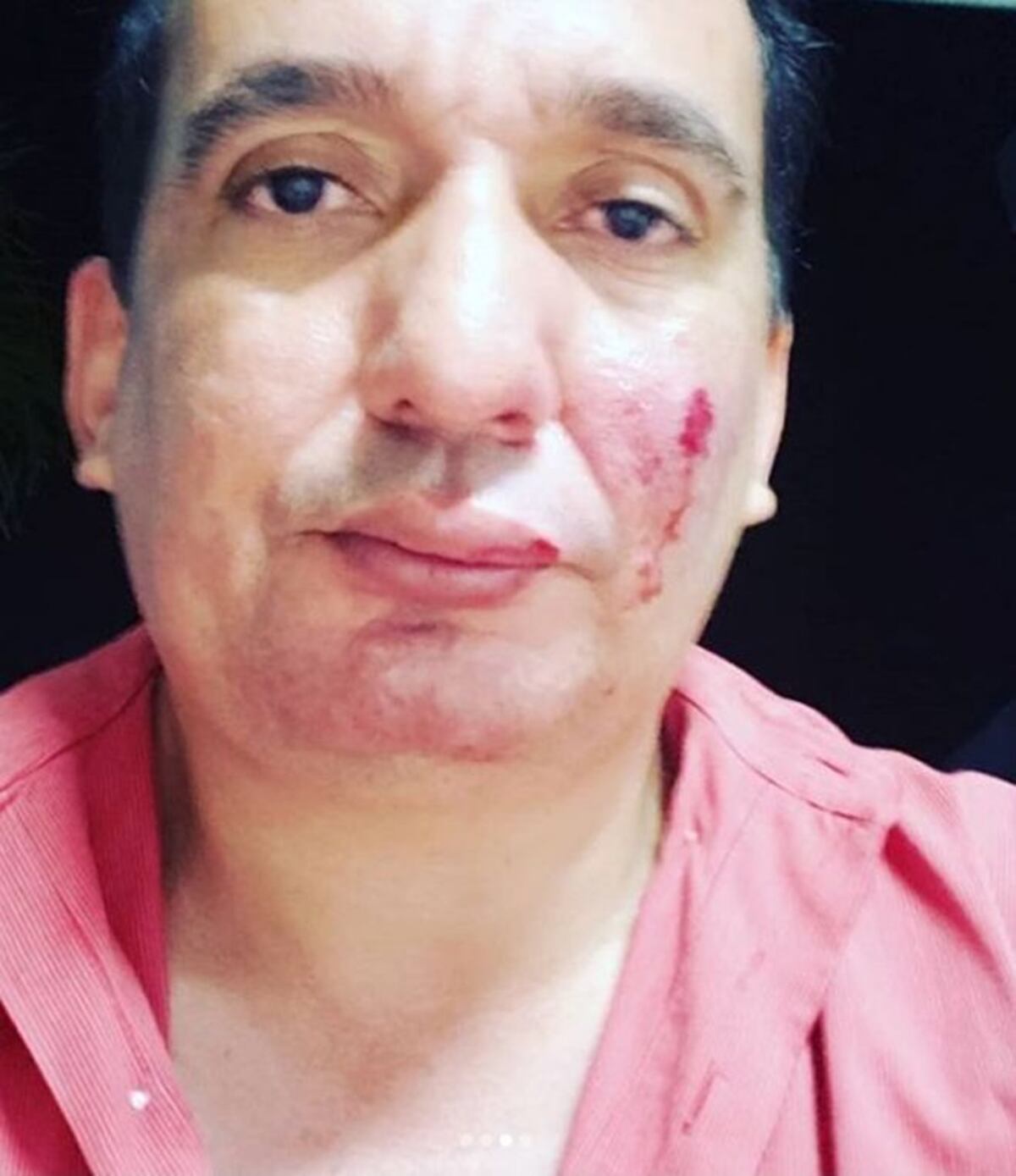 Músico panameño se estrella en su auto. Choca contra una cuneta