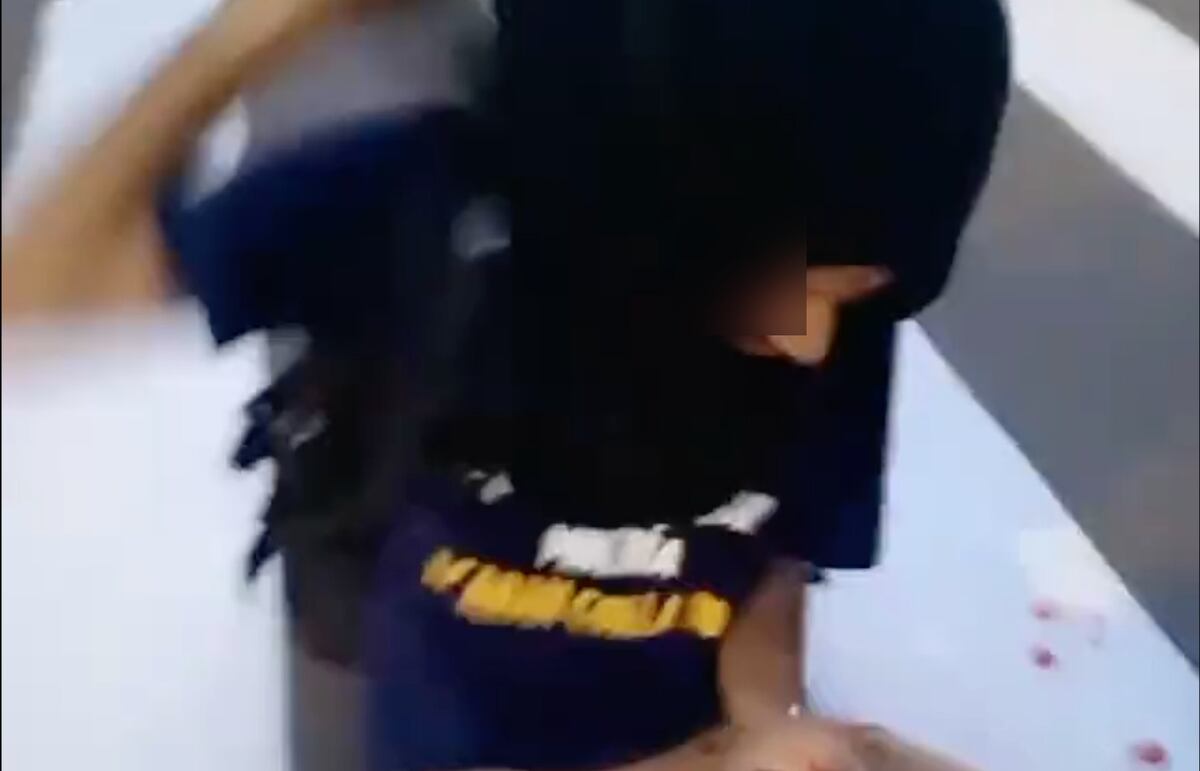 Fotógrafo herido en las protestas contra el contrato minero pierde un ojo