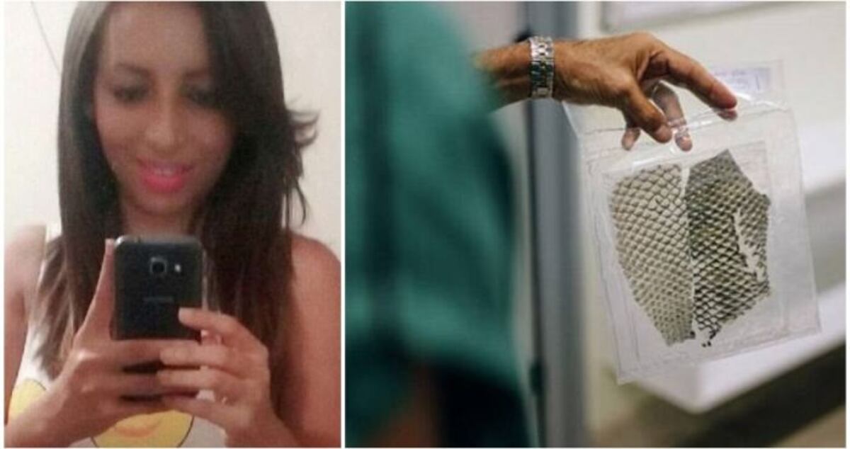 Una mujer en Brasil nació sin vagina y se la reconstruyen con piel de pez