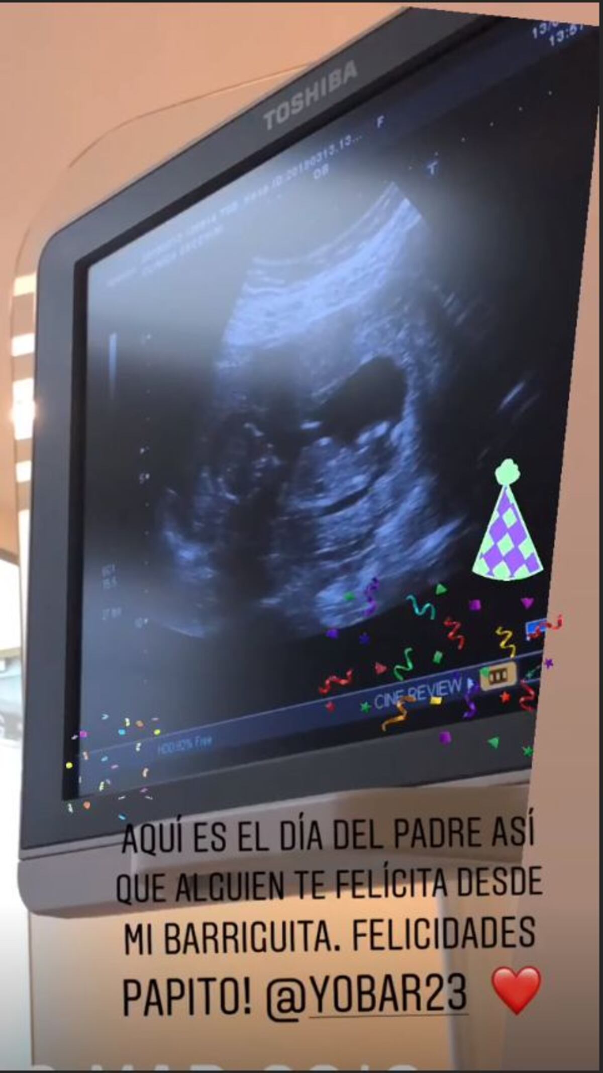 Yoel Bárcenas espera por su segundo hijo; tendrá sangre mexicana