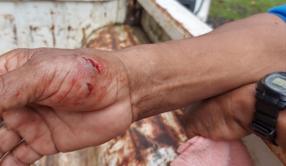 Lagarto se pone furioso por su captura y muerde a funcionario