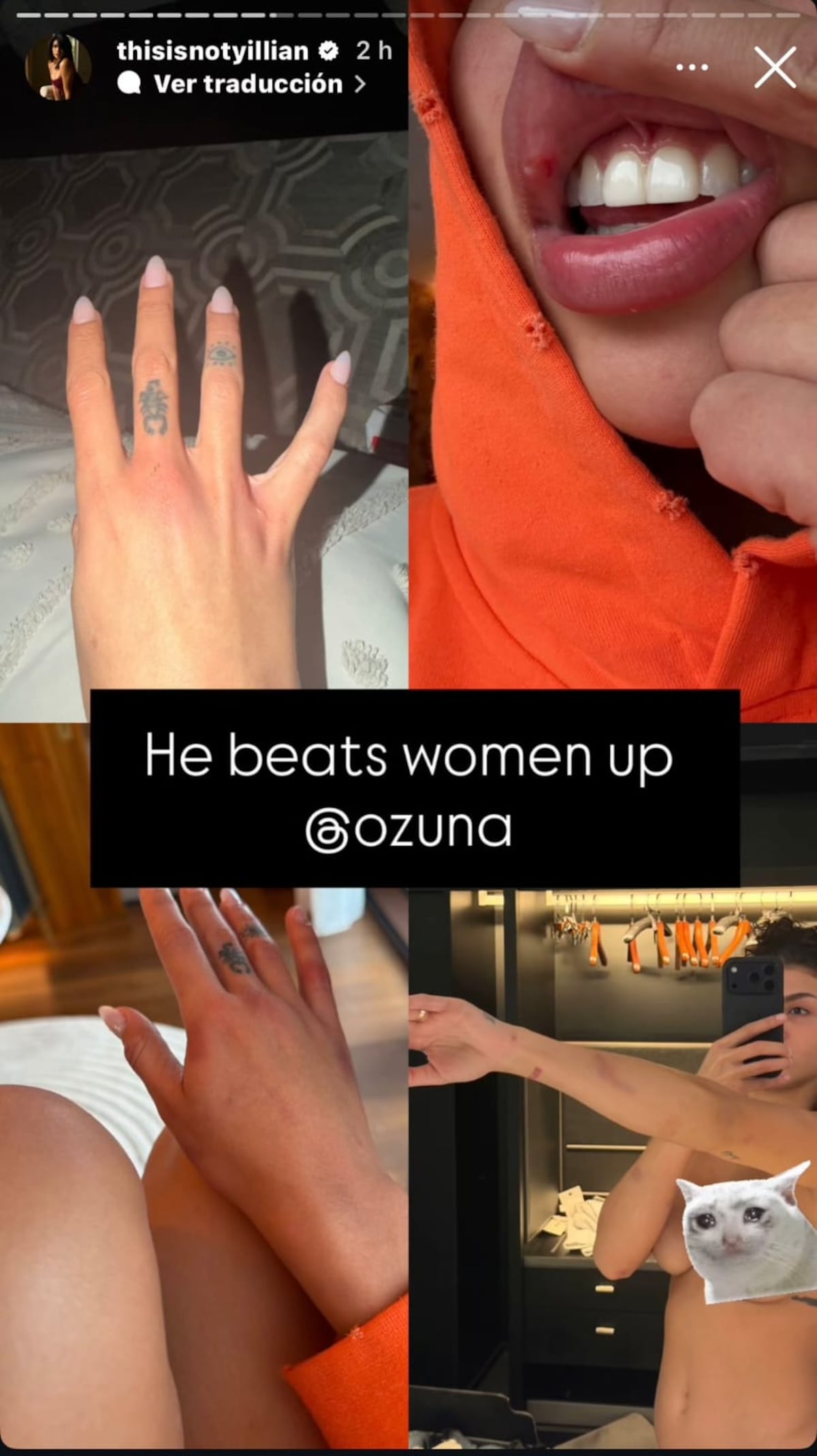 Modelo acusa a Ozuna de presunto maltrato y publica fotos que encienden las redes