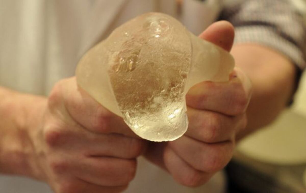 Justicia francesa ordena nuevo proceso en caso de prótesis mamarias defectuosas