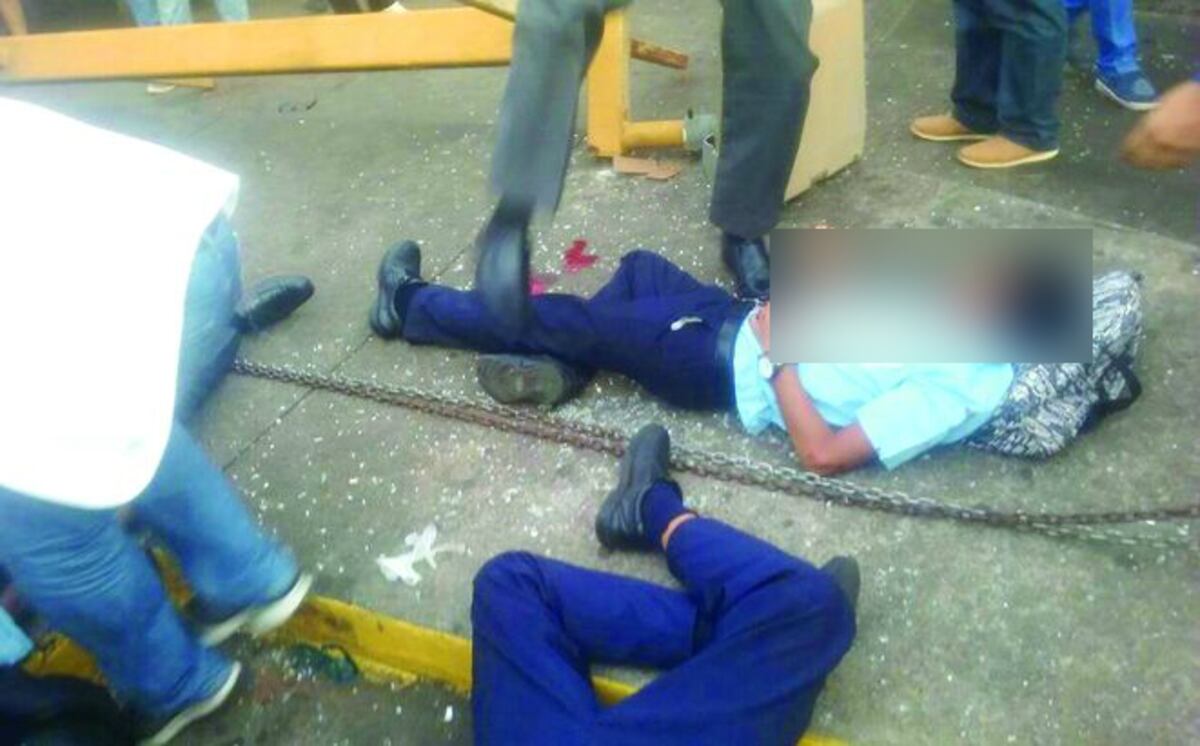 ¡EN ESTADO DELICADO! Uno de los estudiantes después de caerle poste en parada