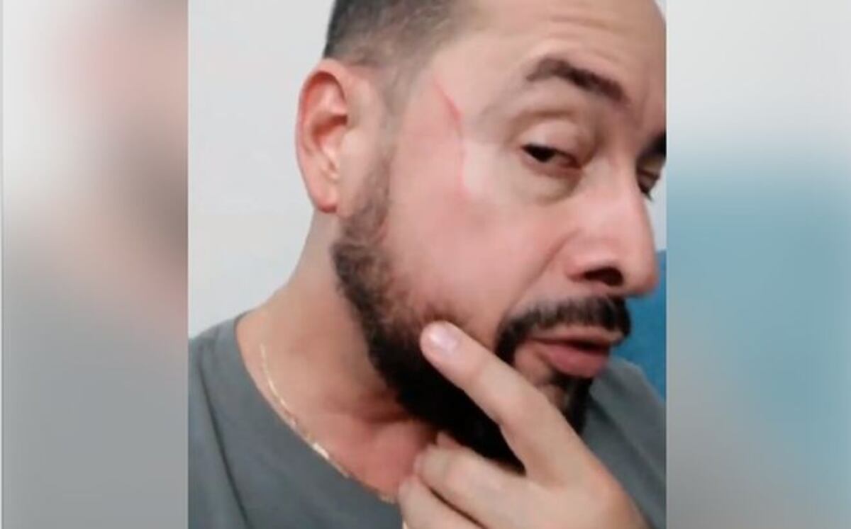 Solo fue un arañazo. Presentador de boxeo dice que logró prensar a su atacante 