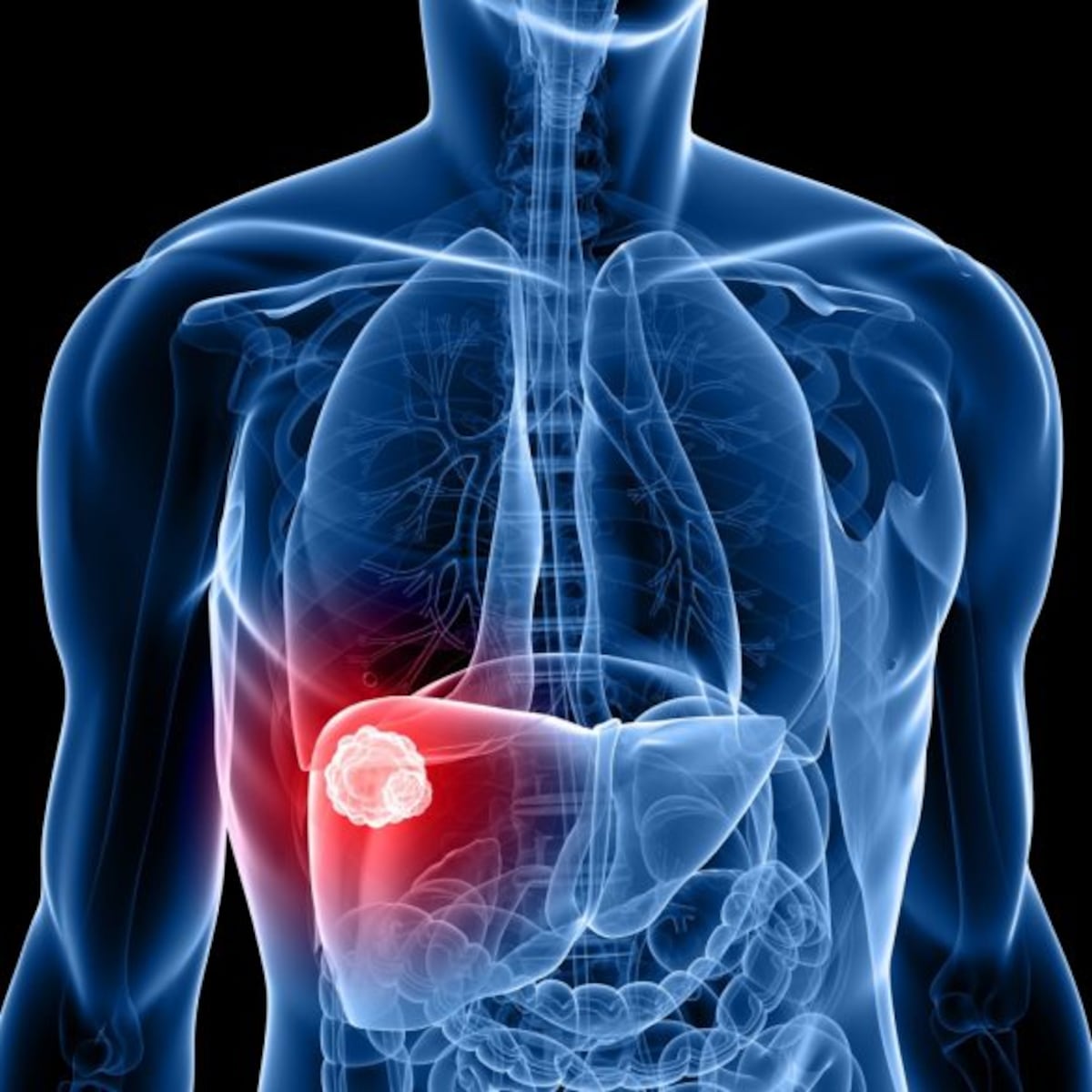 Científicos hallan planta en el Amazonas que ayuda a curar el cáncer hepático