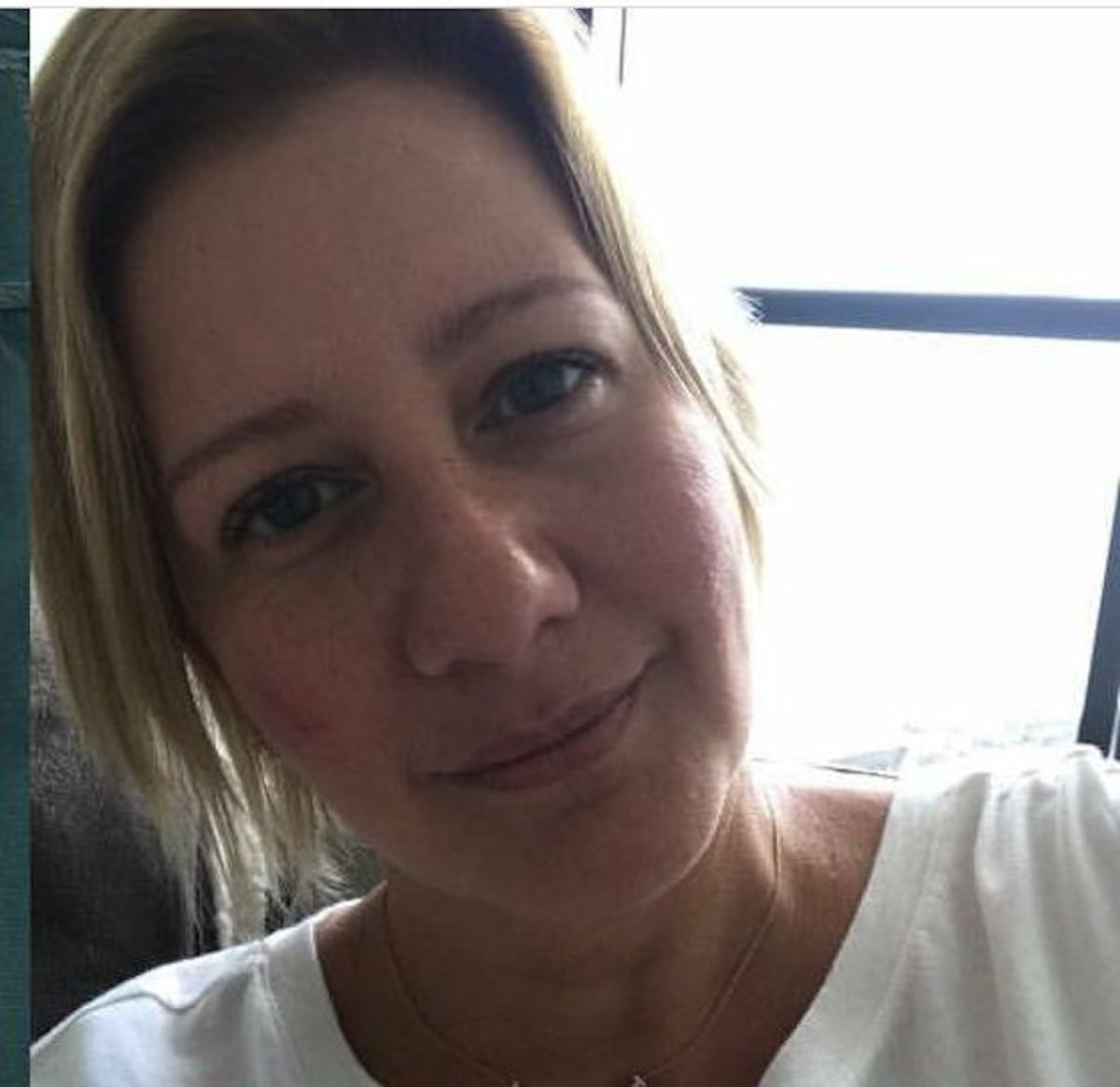 ¡AUCH! Primera Dama Lorena Castillo se lesiona una pierna