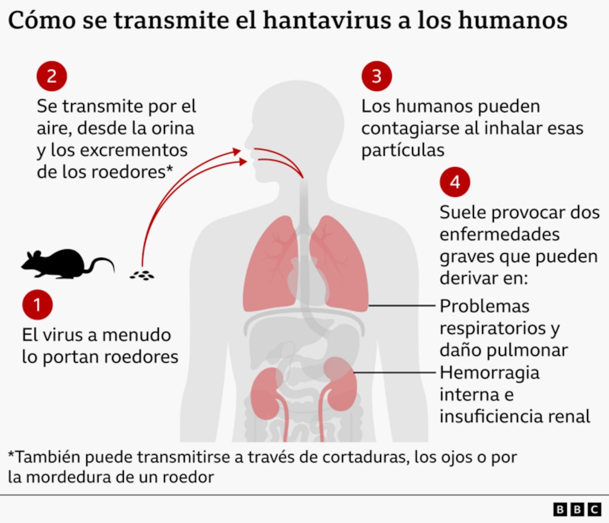 ¿Qué es el hantavirus y por qué preocupa? Panamá aclara que la variante mortal del crucero no circula en el país