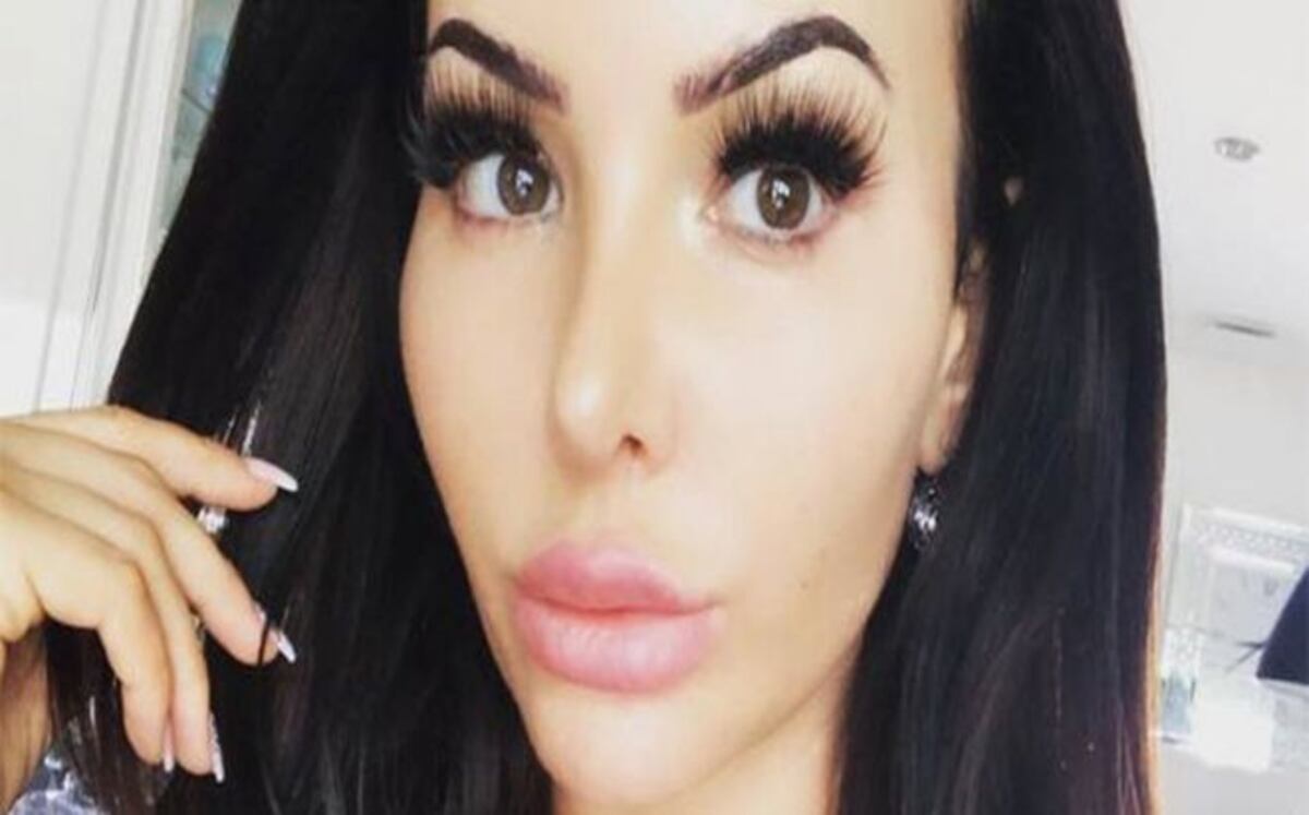 Modelo se opera los glúteos y ahora no se puede sentar