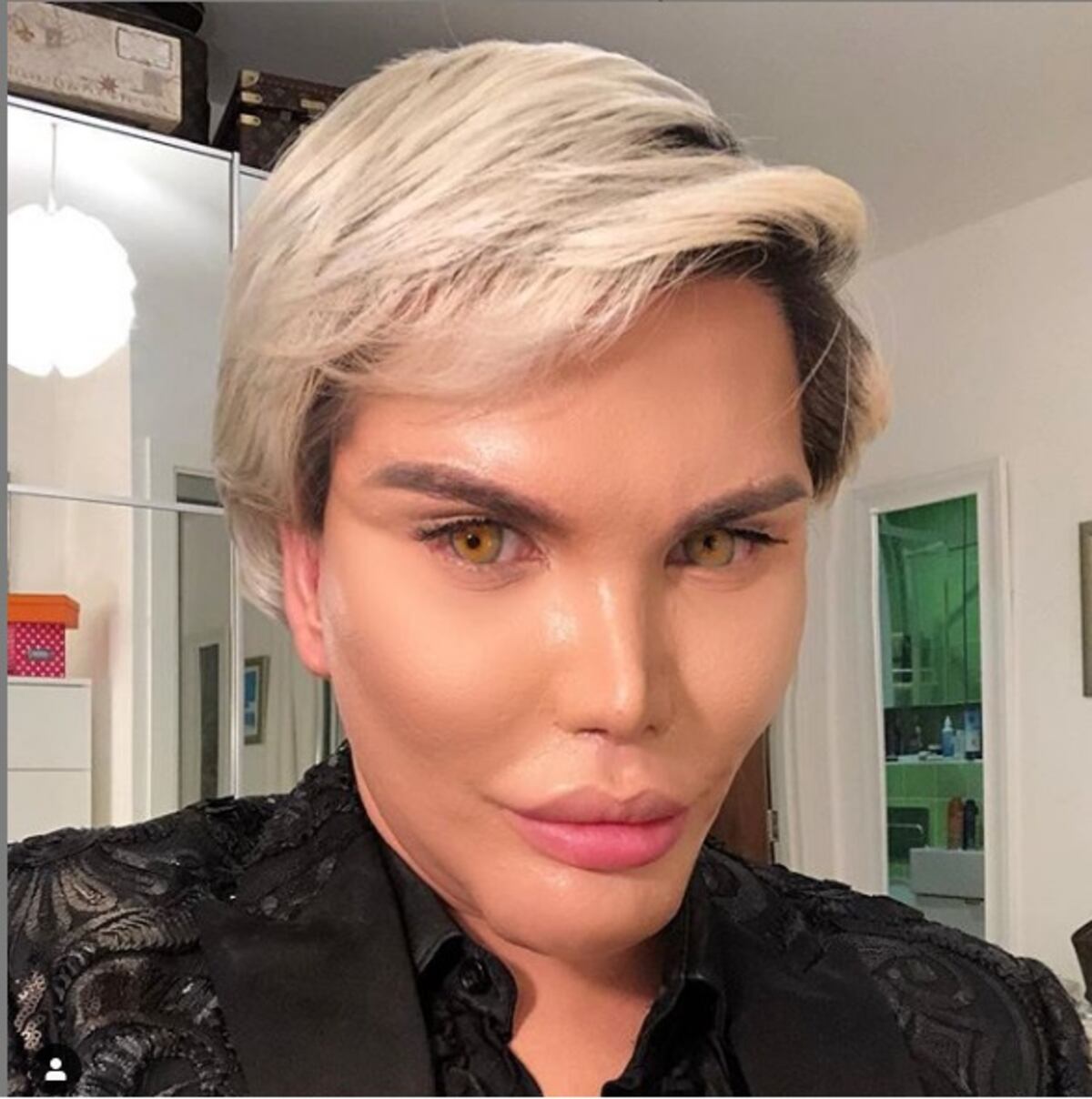 Ken Humano revela que se le rompió el implante de su mentón y sufrió mucho