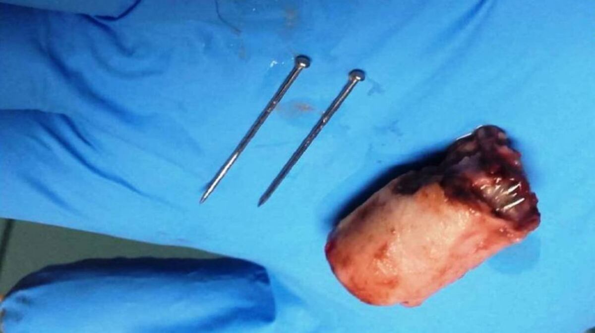 Policía alerta sobre salchichas con clavos para matar a perros