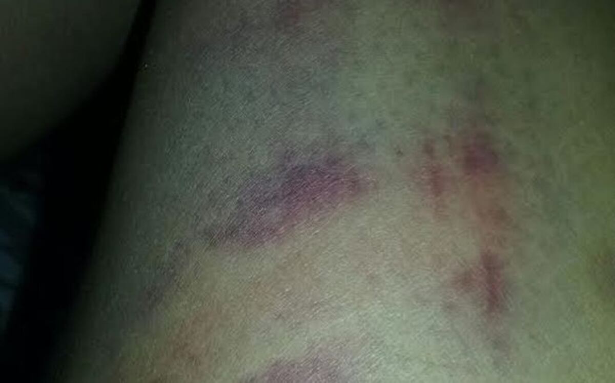 Hombre le da una cuera a su vecina con un azote para caballos en Veraguas 