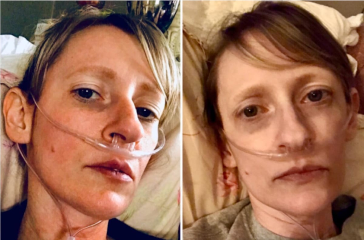 El contundente mensaje de esta paciente a quienes no creen en el coronavirus