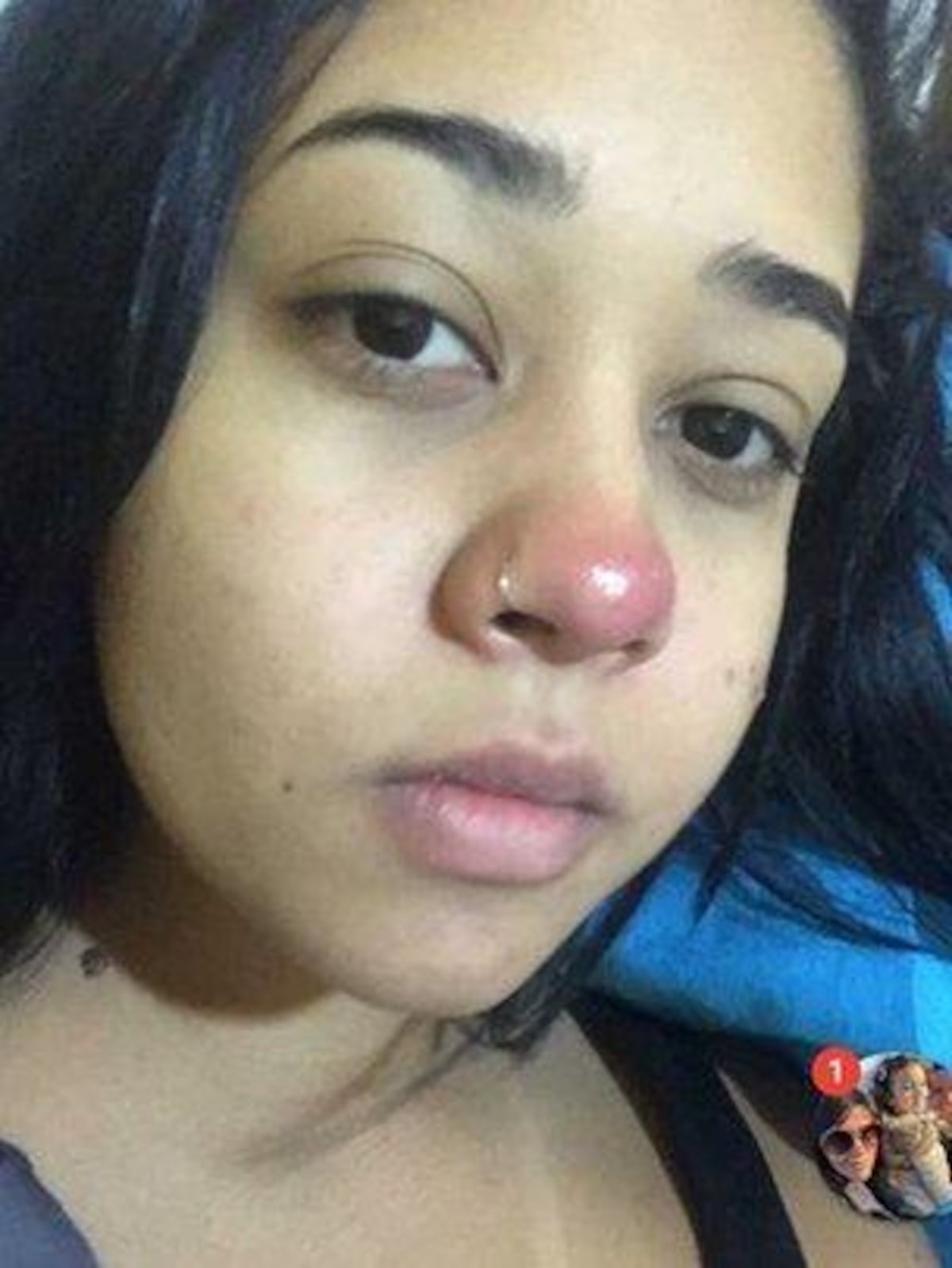 Un piercing en la nariz la dejó sin sentir nada de los senos hacia abajo