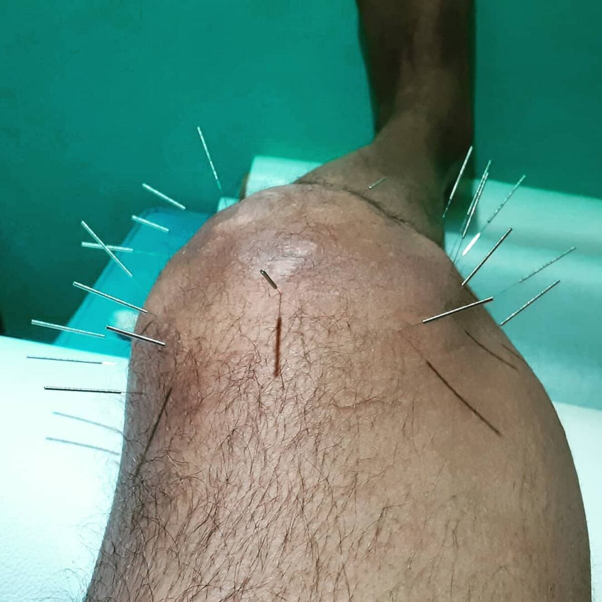 Pide donaciones. Dj Cucaracha necesita una operación de urgencia que cuesta 18 mil dólares