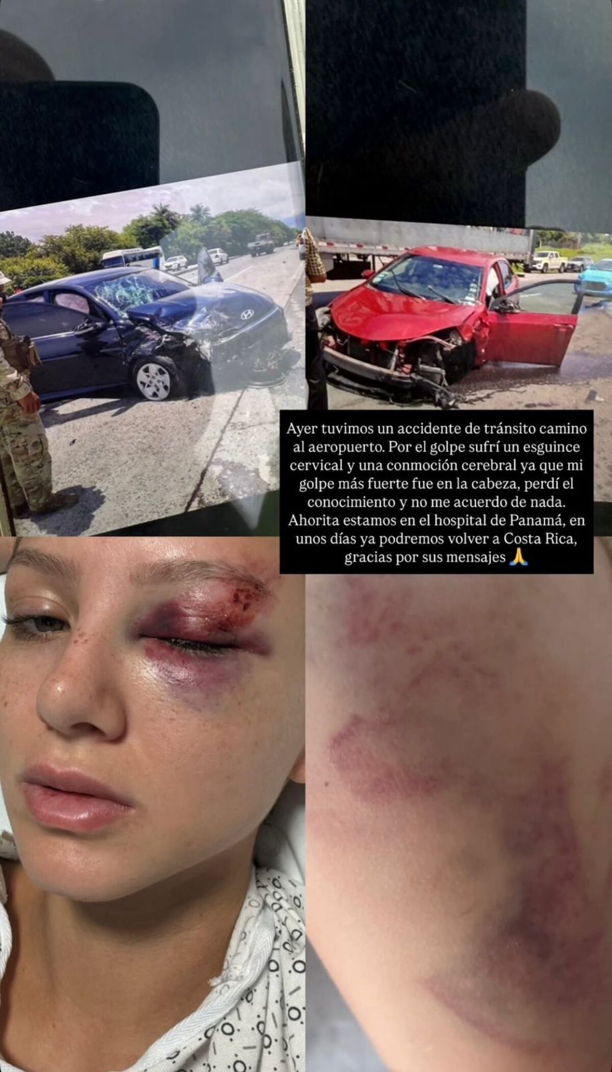 Belleza entre golpes: Miss Tica destrozada en brutal accidente vial en Panamá
