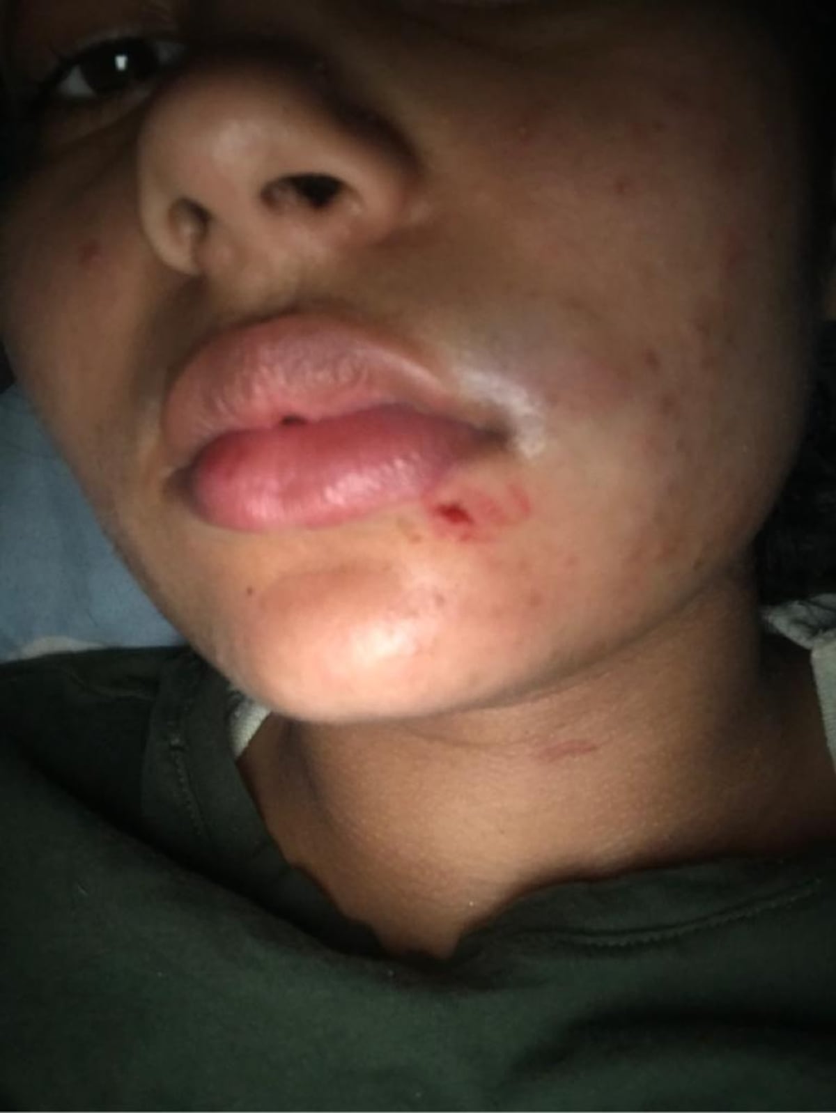 Yemil podría volver a la cárcel. Presuntamente volvió a agredir a otra chica