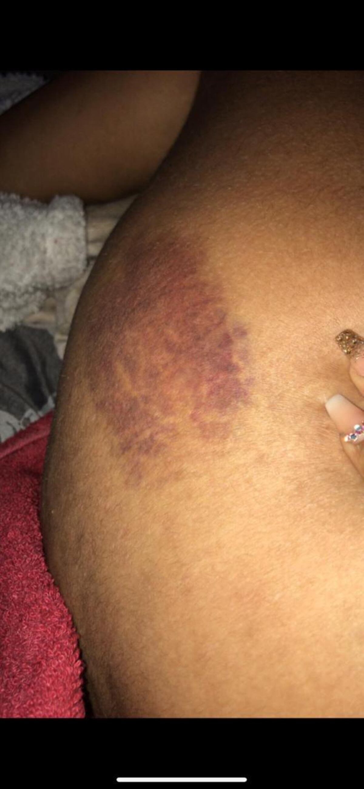 Yemil podría volver a la cárcel. Presuntamente volvió a agredir a otra chica