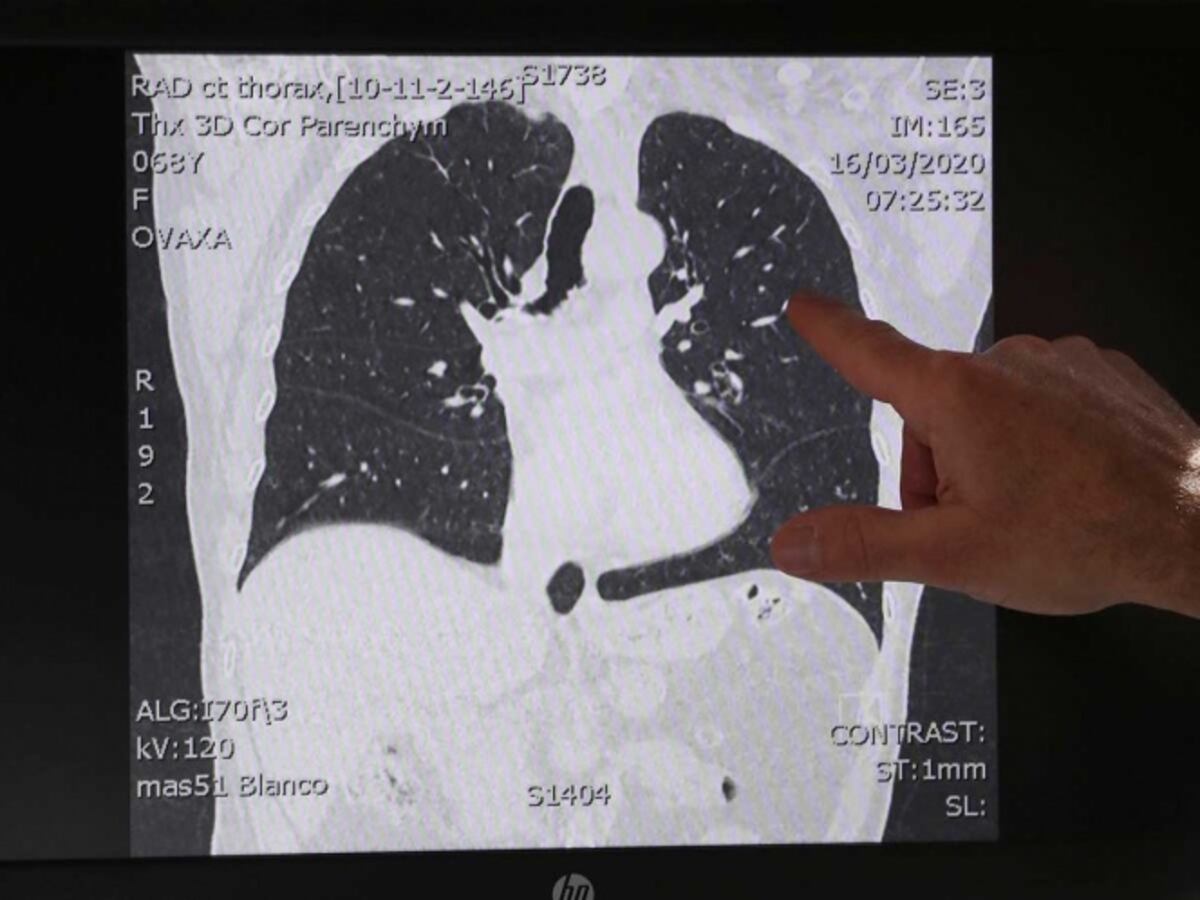 ‘Covid-19 infectará al 70% de la población mundial y duraría 2 años’. Videos