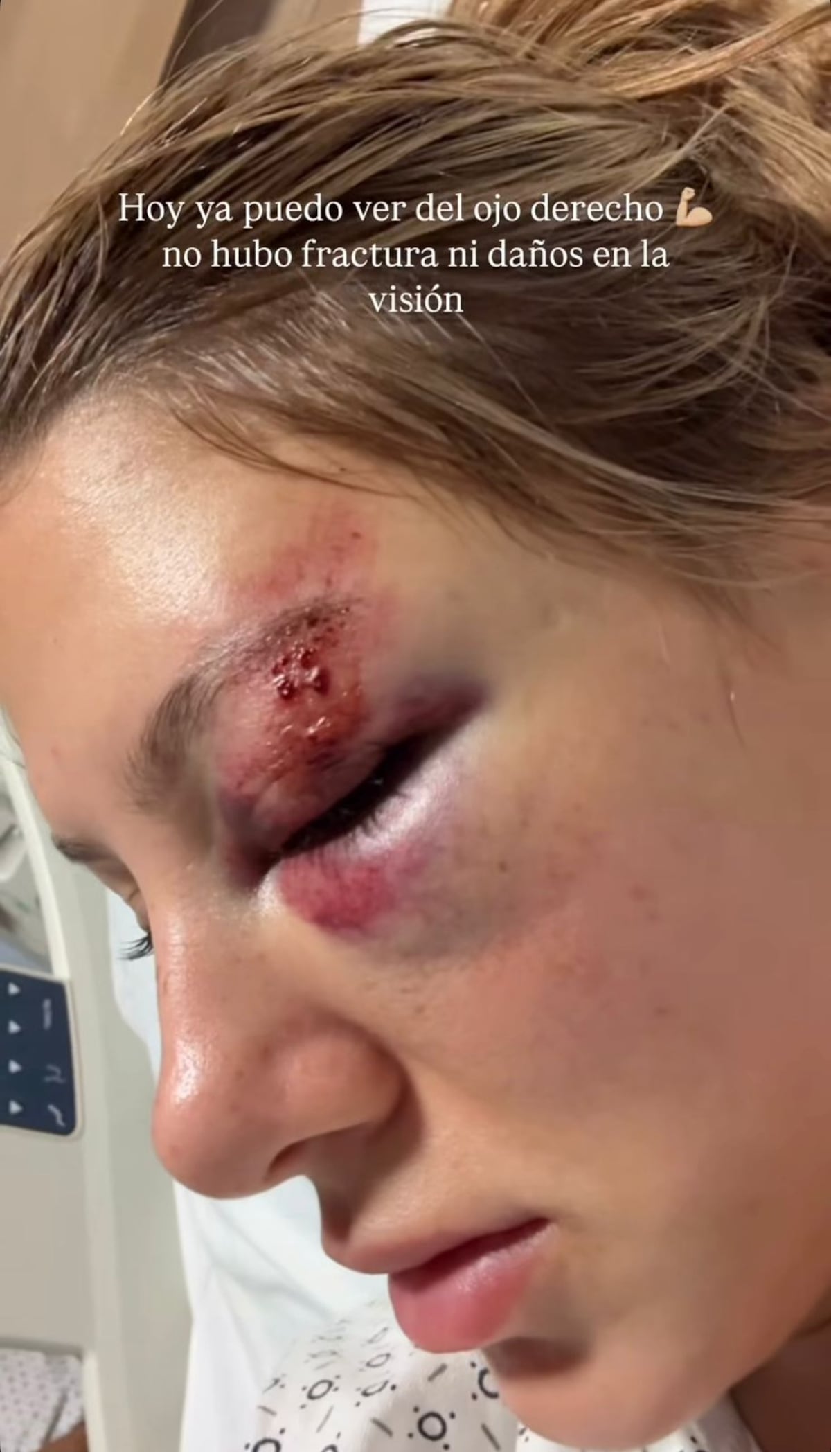 Belleza entre golpes: Miss Tica destrozada en brutal accidente vial en Panamá