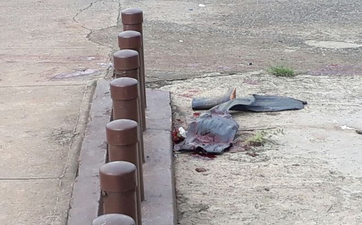 LE DISPARAN EN EL PIE.  Presunto ladrón trató de entrarle a machetazos a policía