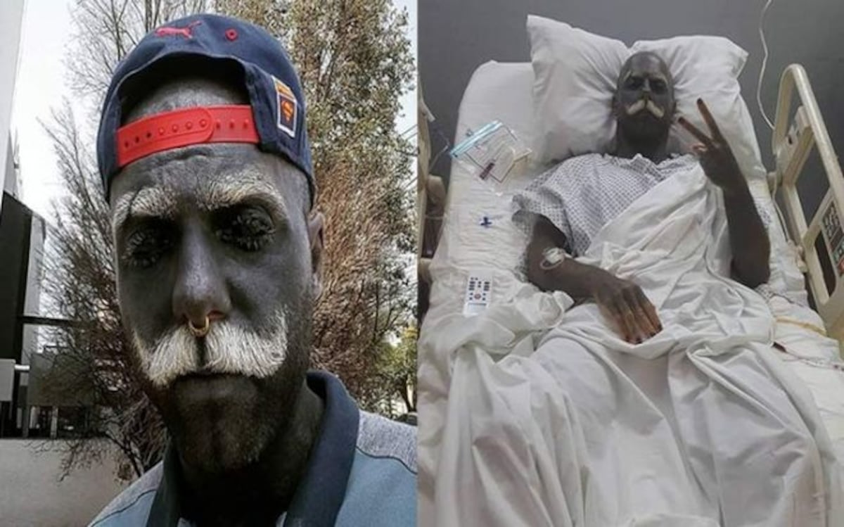 Extirpa sus genitales para poder tener el 100% del cuerpo tatuado