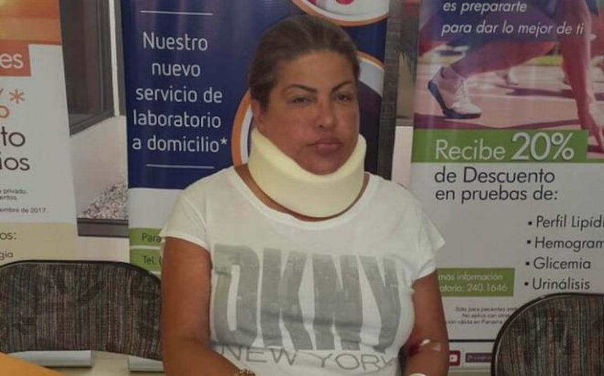 A Alma Cortés no le convenía carnavalear, ahora dice que le robaron