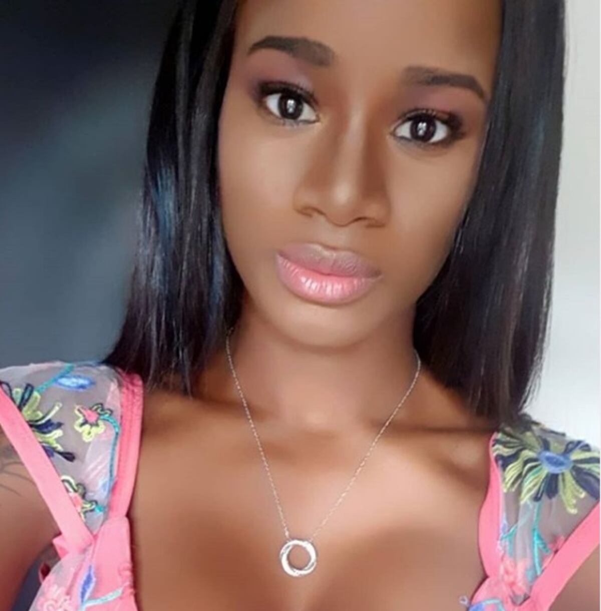 Así quedó la nariz de Yoani Ben +Fotos