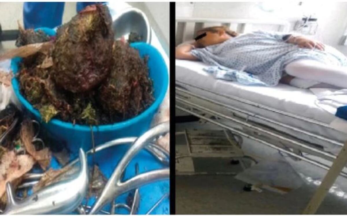 Dijo que estaba por abortar pero lo que extrajeron los médicos no fue un bebé