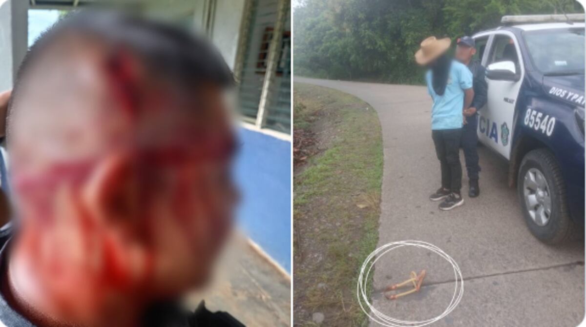 Tensión en Tolé: Policía herido tras recibir piedra durante manifestación