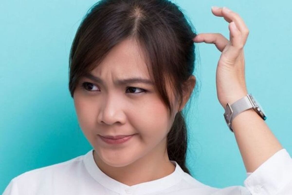 ¿Cómo quitar la caspa?: 4 remedios fáciles