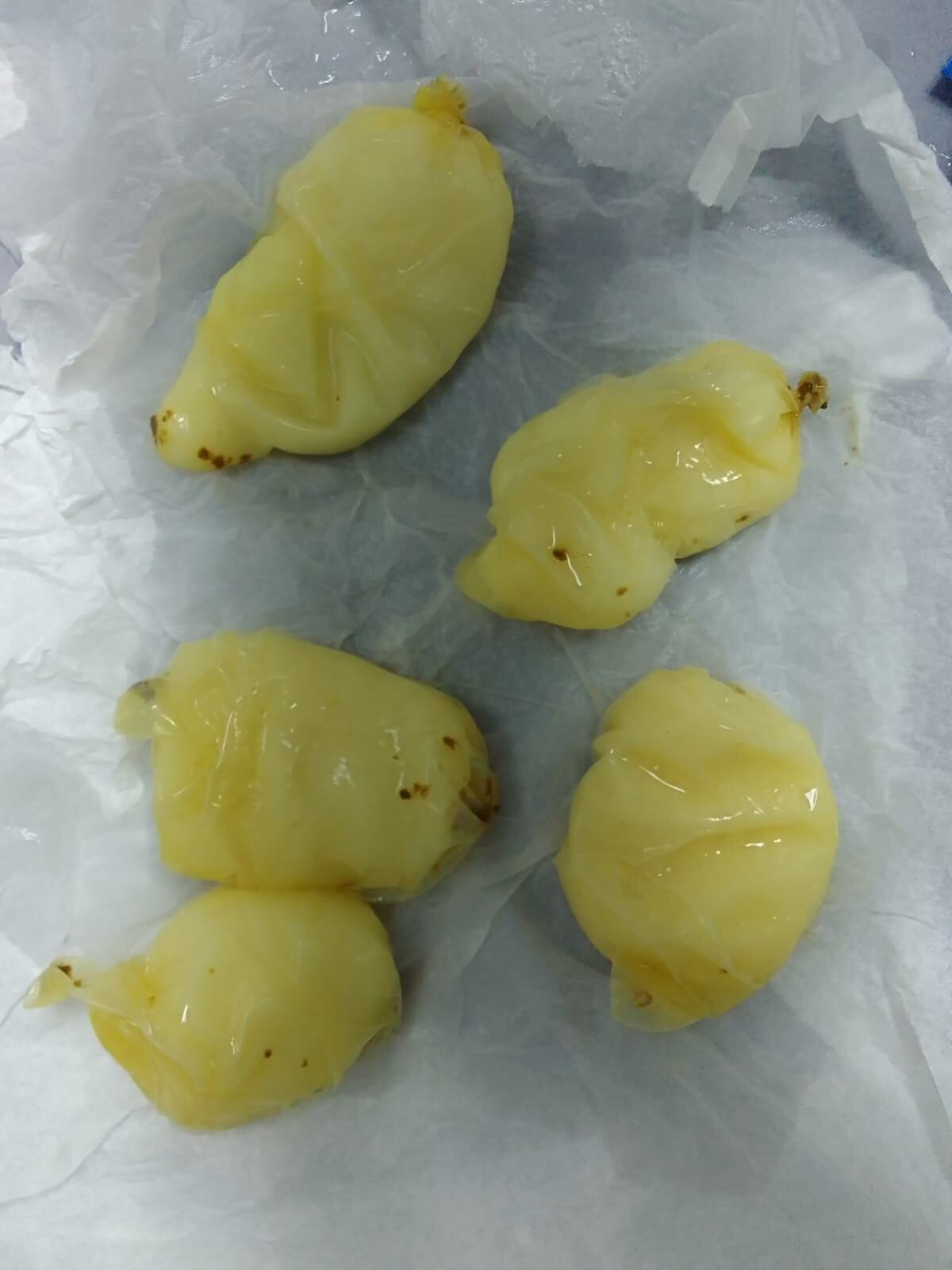 Mujer que se dirigía a Turquía tenía 40 comprimidos de droga en su estómago