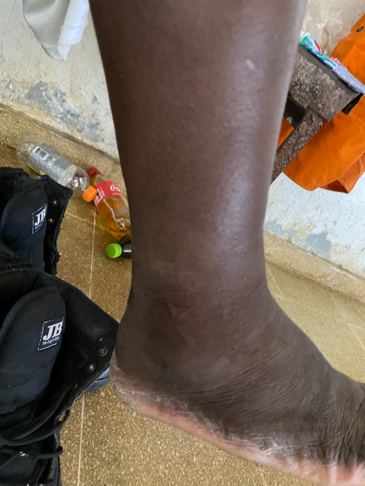 Privado de libertad con trastornos psiquiátricos de la cárcel La Joya, tenía dos meses de estar esposado en una sala