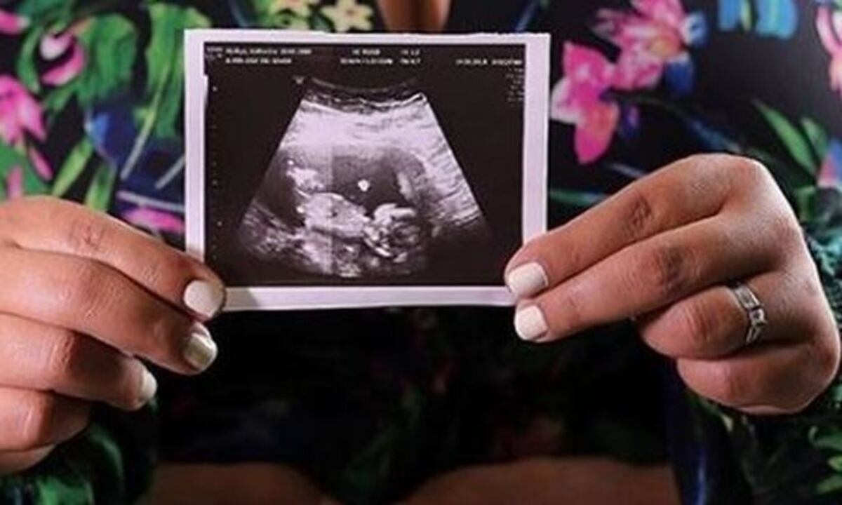 Presentadora de TV Kathy Phillips está embarazada. Asegura que 'es un milagro'