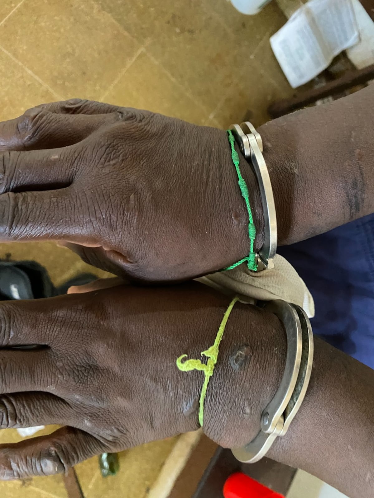 Privado de libertad con trastornos psiquiátricos de la cárcel La Joya, tenía dos meses de estar esposado en una sala