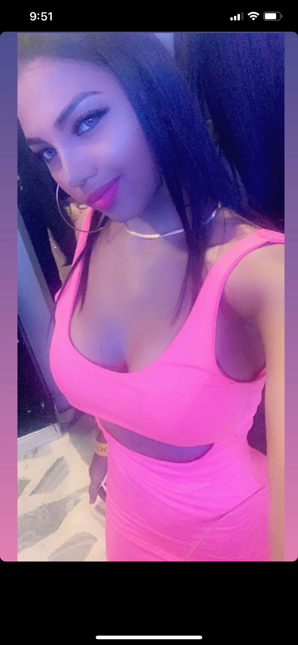 Anyuri mostró su nueva nariz. Mira un antes y después de su transformación 